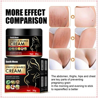 South Moon Dilute Stretch Marks Cream Repair Growth Lines Anti-wrinkle Improve Sagging Dullness Hydrating Whitening Skin Ointment Body Care 30g JOYFEEL