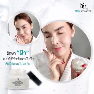 ส่งฟรี‼️ สบู่ล้างหน้าSC เซตสลายฝ้า สิว หน้าเด็ก ผิวใส