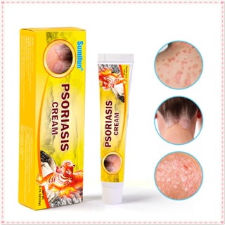 Sumifun Psoriasis Ointment ครีมบํารุงผิว ไม่เหนียวเหนอะหนะ บรรเทาอาการคัน 20 กรัม