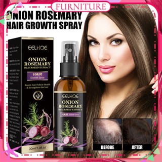 ♕ EELHOE Onion Rosemary Hair Growth Spray ป้องกันผมร่วง ส่งเสริมการเจริญเติบโตของเส้นผม เพิ่มความเงางามของเส้นผม Anti-falling Essence Spray ผลิตภัณฑ์ดูแลเส้นผม FURNITURE