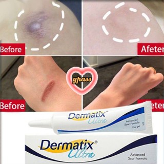 CYREAL Dermatix Ultra Gel For Dark Scars, Dilutes Burns, Old Scars, Pimples And Marks 15g.