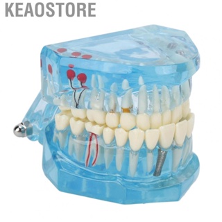 Keaostore Dental Pathological Model Clear Teaching Detachable  Display B