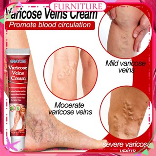 ♕ Eraycee Varicose Veins Cream บรรเทาอาการปวดขาไส้เดือน ปวดบวม ครีมต้านการอักเสบ ส่วนผสมจากธรรมชาติ ผลิตภัณฑ์ดูแลร่างกาย FURNITURE