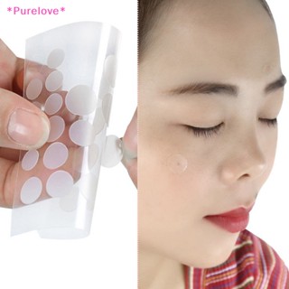 Purelove&gt; แผ่นสติกเกอร์แปะสิว กําจัดสิว อย่างมีประสิทธิภาพ ใหม่