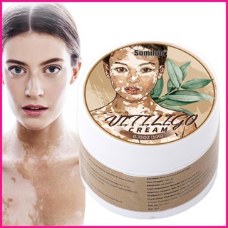 Vitiligo ครีมสมุนไพร กําจัดจุดด่างดํา ขนาด 10 กรัม