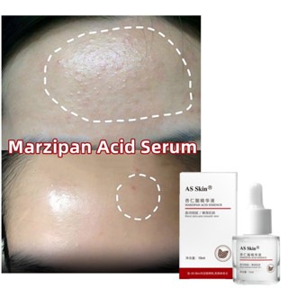 As Skin Marzipan Acid Serum 15 มล. เซรั่มลดรูขุมขน ให้ความชุ่มชื้น กําจัดสิวหัวดํา ชุดฟื้นฟูผิว