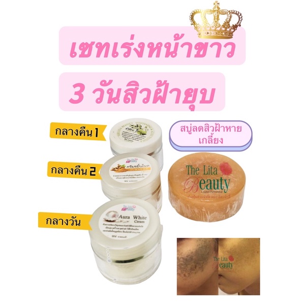 แก้ฝ้าหนา|สำหรับคนที่ใช้อะไรมาฝ้าก็ไม่หลย|ไม่แสบแดง|แก้ฝ้าสิวหาย|อาหารผิวหน้า