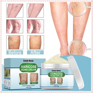 South Moon Varicose Veins Cream Repair Earthworm Spider Leg บรรเทาอาการปวด Red Blood Swelling Ointment Natural Herbal Treatment Body Care Product 20g JOYFEEL