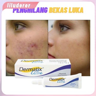 Dermatix ครีมลบรอยแผลเป็นที่มีประสิทธิภาพ Scar Gel รอยแผลเป็นเก่า Acne Scars Treatment Scar Remover 1 ชิ้น HO