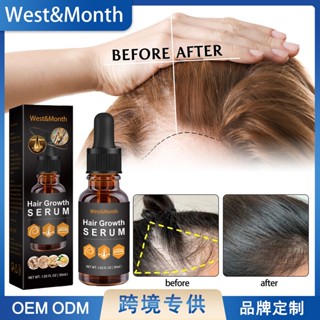 Spot second hair# West Month hair nutrition growth Essential Oil Moisturizing Care promote hair dense hair care essential oil 8cc