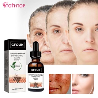 Gfouk 30ml Facial Essence Strong Effects Powerful Whitening Anti Wrinkle Cream Remove Melasma Acne Spots Pigment Melanin Dark [TOP]