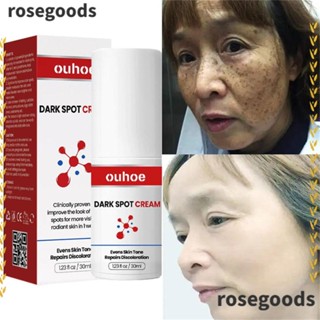 Rosegoods1 ครีมกําจัดจุดด่างดํา กระ จุดด่างดํา สําหรับผิวกระจ่างใส