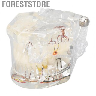 Foreststore Disease Implant  Model Disease  Model Dental Implant  Model