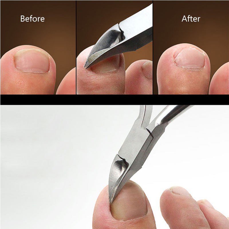 กรรไกรตัดเล็บขบทรงโค้งปากนกอินทรีย์ ตัดเล็บขบฝังลึก กรรไกรตัดหนังเล็บ Pedicure Scissors Nail Pedicure Kit ราคา ถูกที่สุด ดีลบีเคเค แกลเลอรีภาพที่ 6