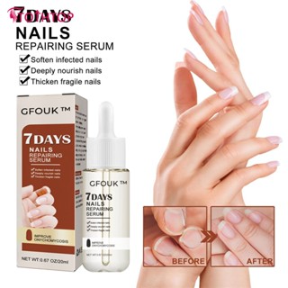 Cfouk 7 Days Nail Repair Essence มือเท้า Onychomycosis Rotten Toenail Soft Nail Thickeningtreatment Moisturizing Care Essence Body Care 20ml [TOP]