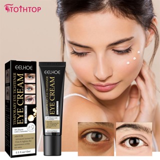 Eelhoe Blemish Eye Cream เจลบำรุงผิวต่อต้านวัยลบความหมองคล้ำ 20g [TOP]