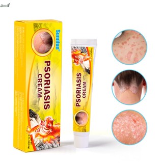 Sumifun Psoriasis Ointment Skin Ointment โรคผิวหนัง กลากเกลื้อน อาการคัน Antipruritic Ointment 20g qccuot