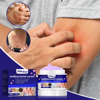 30g Psoriasis Treatment Cream ครีมรักษากลาก Psoriasis Cream Anti Itch Cream Aube