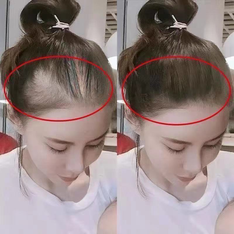 ✨สต็อกพร้อม✨Muscle Source Beauty Creation Hair Tonic Polygonum Multiflorum Herbal Hair Strengthening