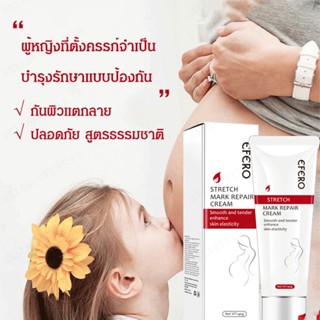 Prenatal ครีมบํารุงผิว สําหรับคุณแม่ตั้งครรภ์