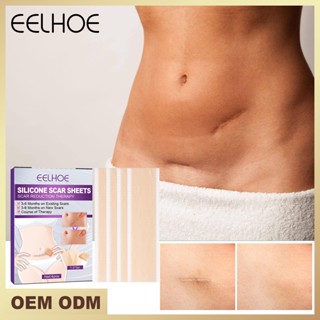 พร้อมส่ง EELHOE แผ่นซิลิโคน ลดรอยแผลเป็น รอยแผลเป็นจากแผลเป็นจากแผลเป็น ผ่าตัด 0616hw