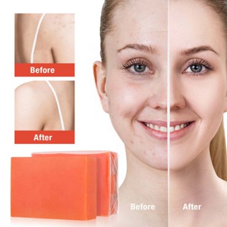 [Beautyoufeel] Kojic Acid Soap Skin Lightening Whitening Cleansing Handmade Soap With Label