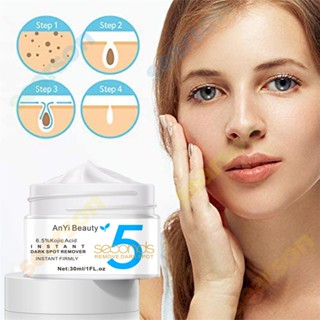 Anyi Beauty kojic acid black spot removal cream cream skin anti-wrinkle moisturizing cream 30ml 【searson】 【searson】