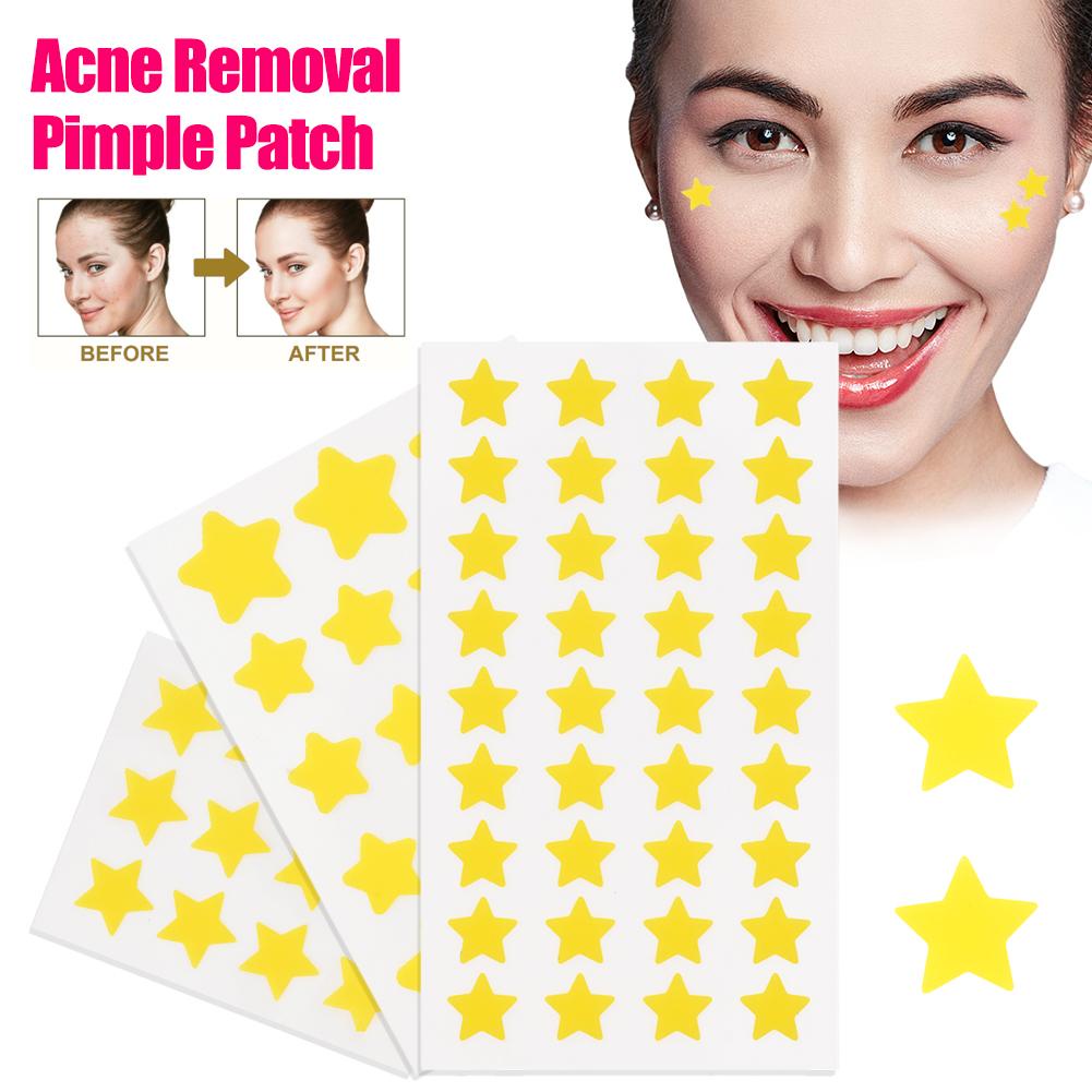 ซื้อ แผ่นแปะสิว น่ารัก รูปดาว กันน้ํา Acne Patch 12 ชิ้น 18 ชิ้น 36 ชิ้น