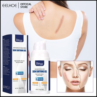 EELHOE Scar Desalination Gel Scar Repair การผ่าตัดแผลเป็น Pregnancy Smoothing Skin Care Gel -eelhoe