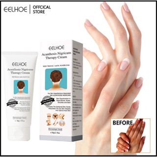 EELHOE Black Spine Skin Repair Cream Melanin Repair Cream Body Whitening Cream Intimate Area Pink Essence Underarm Knee Butt Dullness Brighten Improve Facial Body Care-Eelhoe