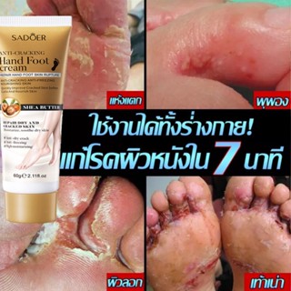 ทรีตเมนต์ 100% ❖ ครีมดับกลิ่นเท้า ครีมบำรุงเท้าช่วยบรรเทาปัญหาเท้าลอกและกลิ่นได้อย่างรวดเร็ว