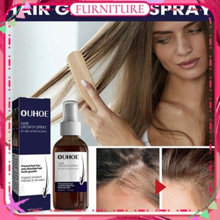 ♕ Ouhoe Hair Growth Spray ป้องกันผมร่วง กระตุ้นการเจริญเติบโตของเส้นผม ให้ความชุ่มชื้นแก่หนังศีรษะ ซ่อมแซมผมเสีย ผมหนาแข็งแรง ผลิตภัณฑ์ดูแลร่างกาย FURNITURE