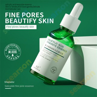 Salicylic Acid Fine Pore Removal Essence Blackhead Repair Acne Seal Closed Anti-Acne Cream Essence 【searson】 【searson】