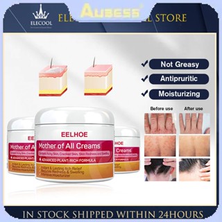 Eelhoe Cream Anti Fungal Cream Eczema Psoriasis Cream Ointment Eczema Treatment Cream For Eczema Skin Care ครีม TECH3