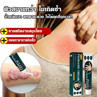 [1/2 ชิ้น]ครีมรักษาโรคผิวหนังสะเก็ดเงินแก้ผิวคัน