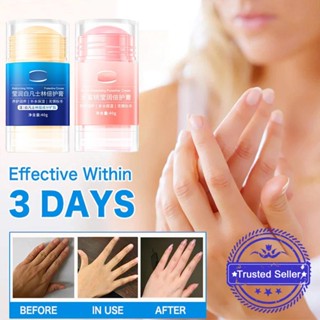 Vaseline ครีมบํารุงผิวมือ เท้าแตก ให้ความชุ่มชื้น ป้องกันการแตก W0O6