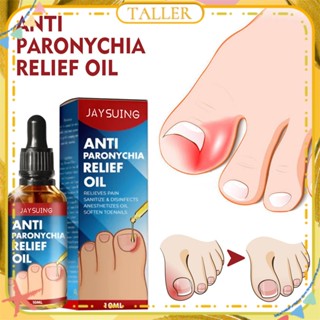 พร้อมส่ง Jaysuing Anti Paronychia Relief Oil Repair Embedded Nail Thickening Grey Nail Relieve Pain Ditch Soothing Care Oil Body Care 10ml TALLER