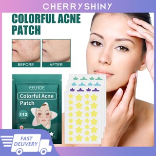 Eelhoe 112patches Paste Star Pimple Patch ลดการเกิดแผลเป็น