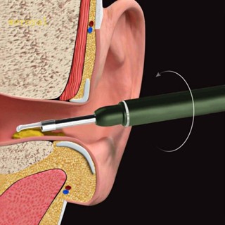 Weroyal ไม้แคะหูอัจฉริยะ สําหรับทําความสะอาดหู กล้องเอนโดสโคป