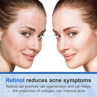 Retinol Face Cream Vitamin A Anti Aging Anti Wrinkles Acne Moisturizer