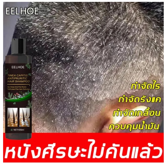 EELHOEยาสระผมเชื้อรา 100ML ป้องกันรังแคและลดความมัน บำรุงหนังศรีษะ ให้ผมเนียนนุ่ม ลดอาการคันศีรษะ ลดรังแค แชมพูขจัดรังแค
