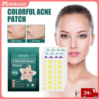 Eelhoe 112 ชิ้นแผ่นแปะสิวกำจัดสิว Femle Women Acne Hydrocolloid Stickers Acne Pimple Master Patch Star Pimple Patch