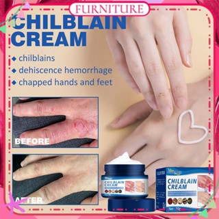 ♕ South Moon Chilblain Cream Anti Drying Crack Foot Heel Hand Repair Cream Moisturizing Skin Removal Dead Skin Anti-chapped Treatment Winter Body Care FURNITURE เฟอร์นิเจอร์