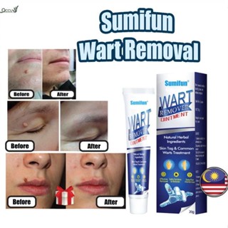 Sumifun Wart Removal Body Warts Treatment Cream Skin Tag Remover เจลกำจัดฝ้า Buang Tahi Lalat, Ketuat, Kutil qccuot