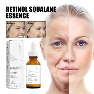 Retinol เซรั่มยกกระชับผิวหน้า ต่อต้านริ้วรอยแห่งวัย ให้ความชุ่มชื้น กระชับผิวหน้า ขนาด 30 มล.