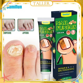 ✧Ready Stcok Sumifun Nail Fungus Cream Repair Onychomycosis ลดการติดเชื้อราที่เล็บ Anti-bacteria Nourishing Toenail Ointment Body Care TALLER