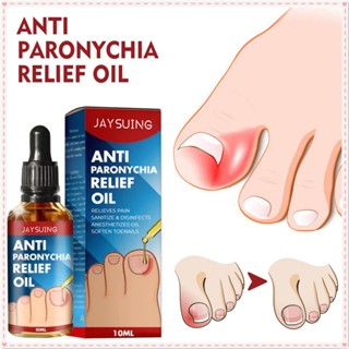 Jaysuing Anti Paronychia Relief Oil Repair Embedded Nail Thickening Grey Nail บรรเทาอาการปวด Ditch Soothing Care Oil Body Care Product 10ml JOYFEEL