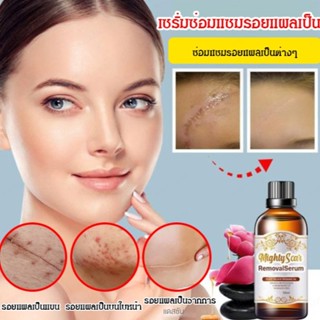 G Generating Care Essence เอสเซ้นบํารุงผิวหลังคลอด ลดรอยแผลเป็นจากรอยแผลเป็น รอยแผลเป็น รอยคลอด