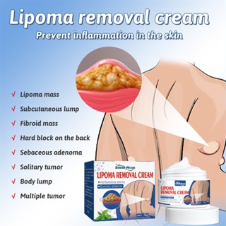 【COD】 South Moon 50g Lipoma Removal Cream The Whole Body Multiple Subcutaneous Conditioning Cream Eliminate Paste Fiber Paste Skin Care Produits