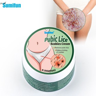 Sumifun Pubic Lice Scabies Cream การดูแลชิ้นส่วนส่วนตัว K20052 qccuot